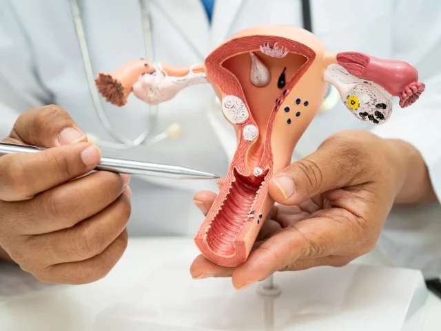 Open Surgery vs Laparoscopic Surgery for Fibroids: What’s Better in Which Case?