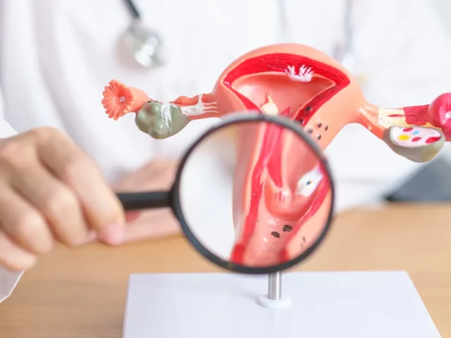 Cervical Cancer: Symptoms, Causes, and Care