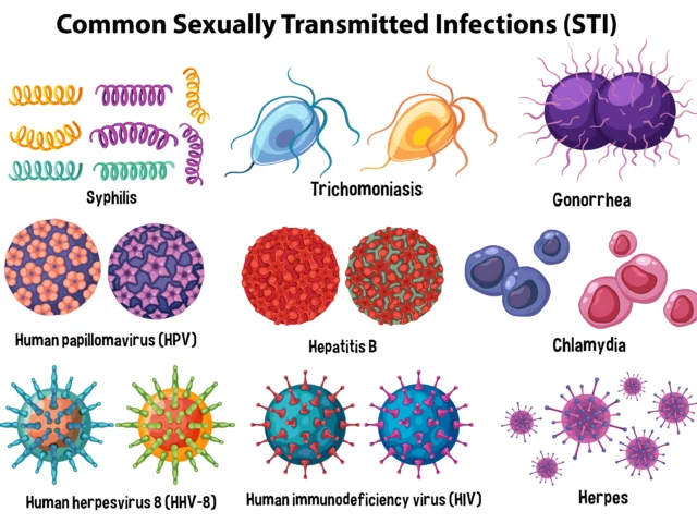 What Is STI (Sexually Transmitted Infection)? Signs, Testing & Treatment for Women