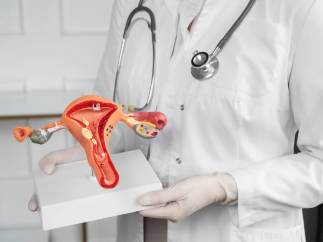 PCOS renamed PMOS: What Changed, What Didn’t, and What It Means for You