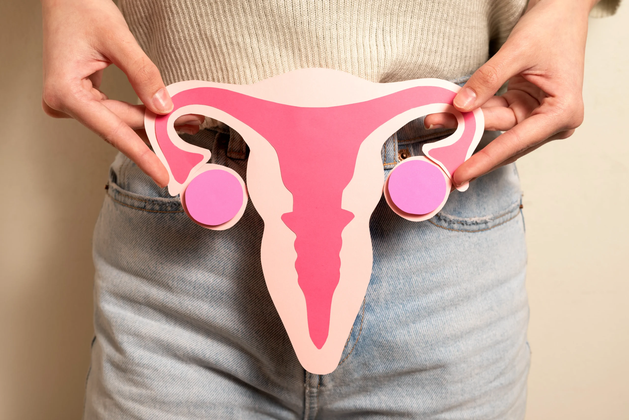 Ovarian Cyst